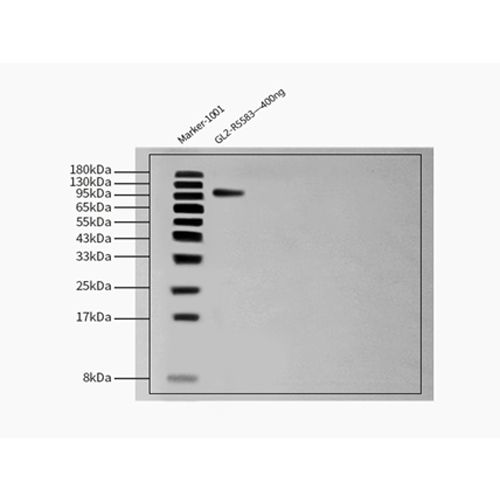 单克隆Anti-Glycoprotein E2 & E1抗体