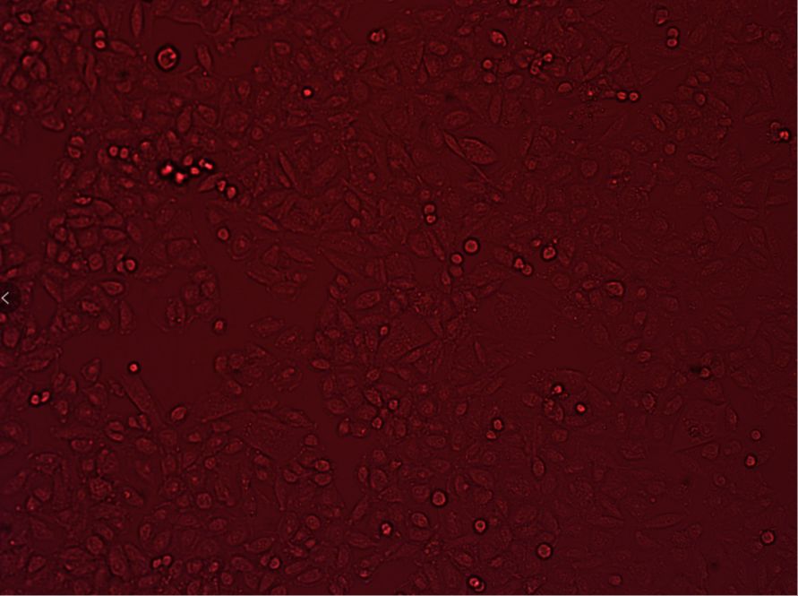 人乳腺癌细胞ER阴性（浸润性乳腺导管癌）JIMT1（STR）