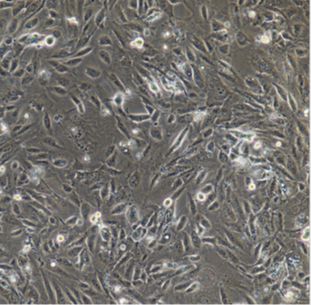 人胃癌细胞SNU16（STR）