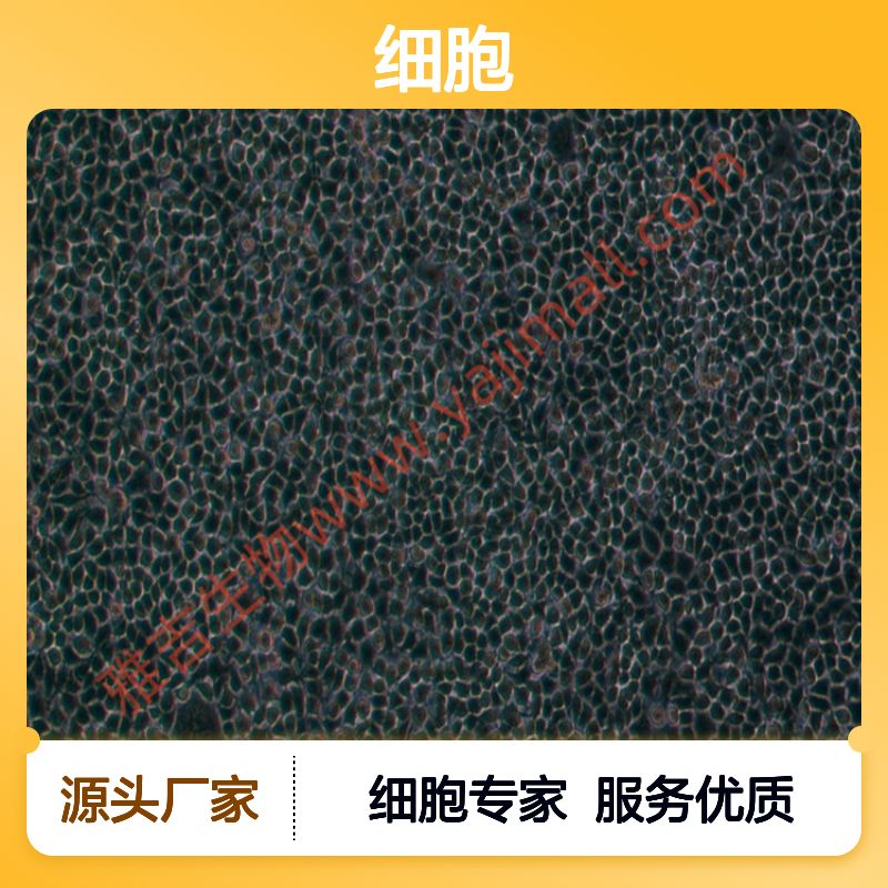 人套细胞淋巴瘤细胞REC1（STR）