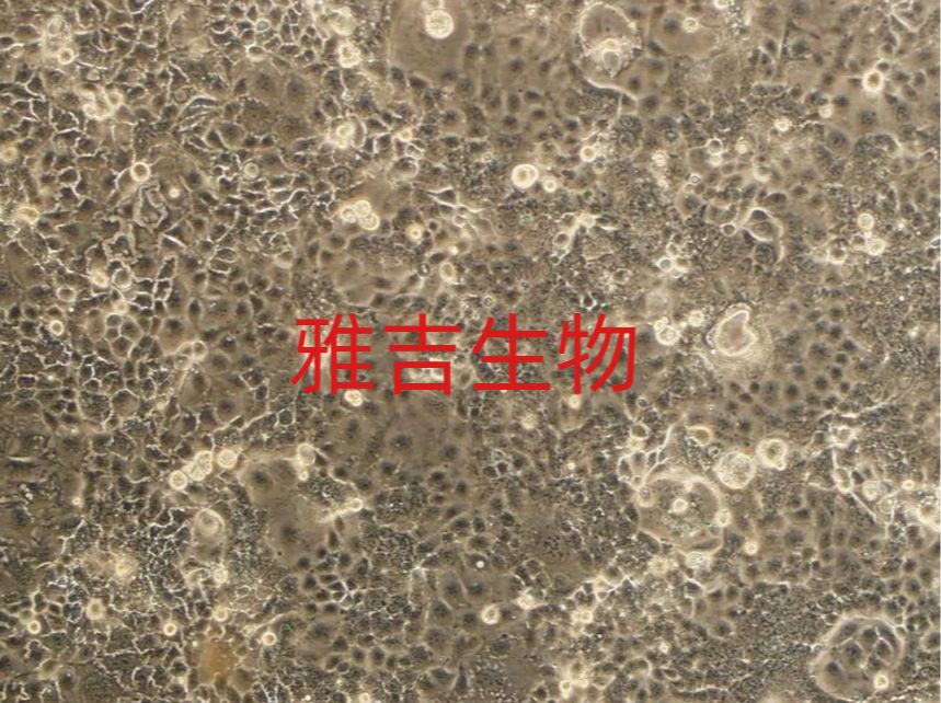 人舌鳞状细胞癌BICR31（STR）