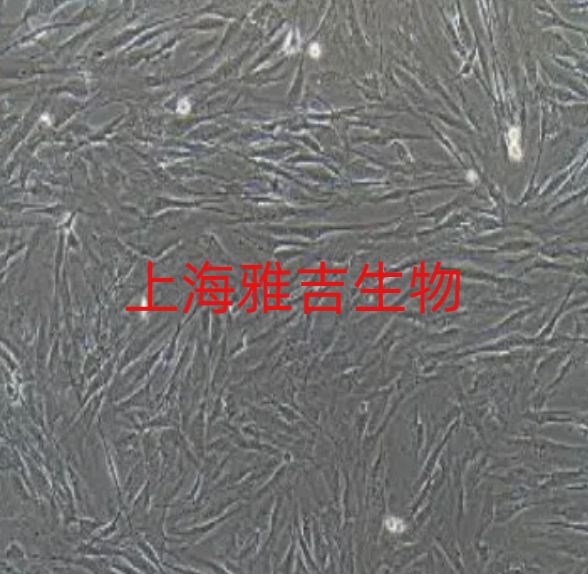 人大脑内皮细胞HBEC5i（STR）