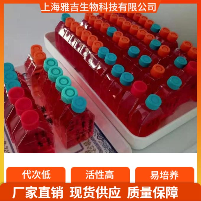 人外周血B淋巴瘤细胞；IM9（STR鉴定正确）