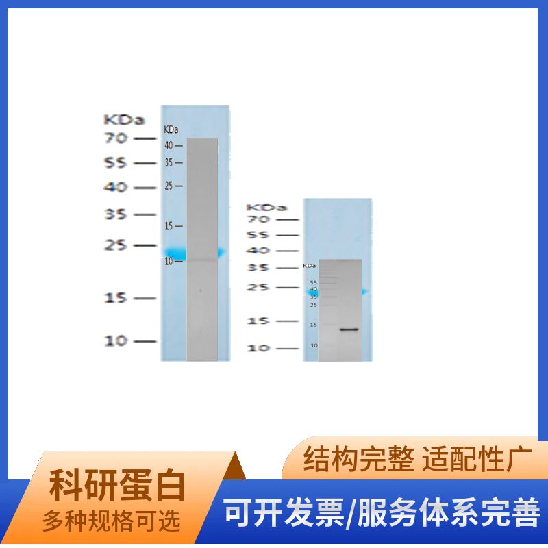 Recombinant Human beta III Tubulin
