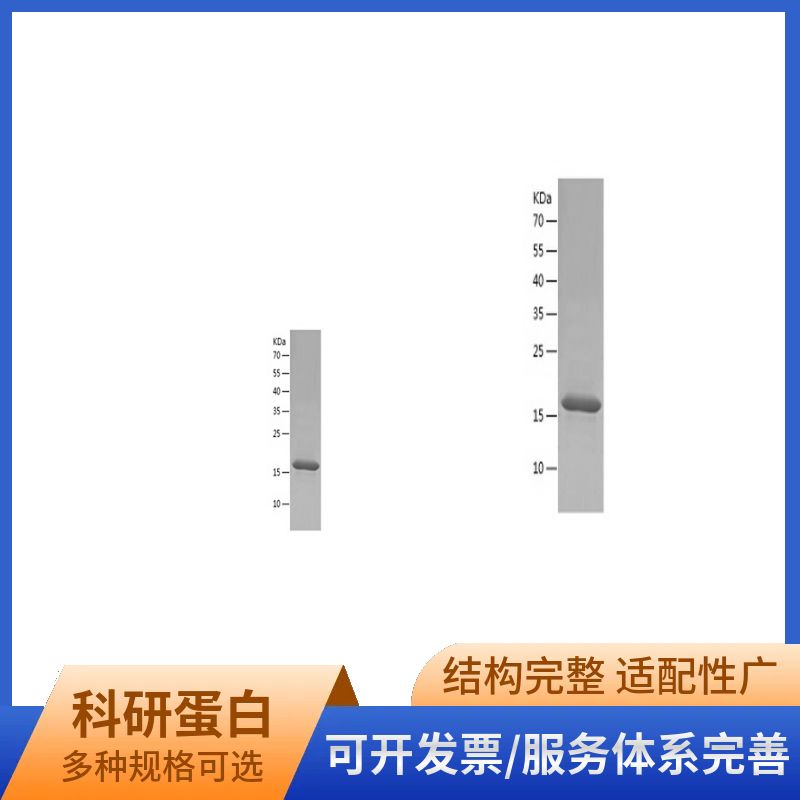 Recombinant Human ATP citrate lyase