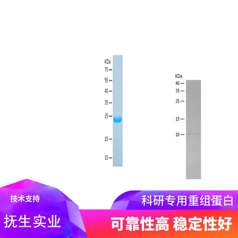 Recombinant Human Aldolase B