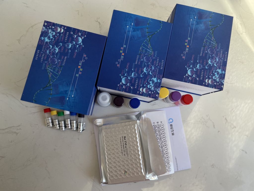 人异性脑炎特异性IgM抗体(JEIgM Ab）ELISA试剂盒