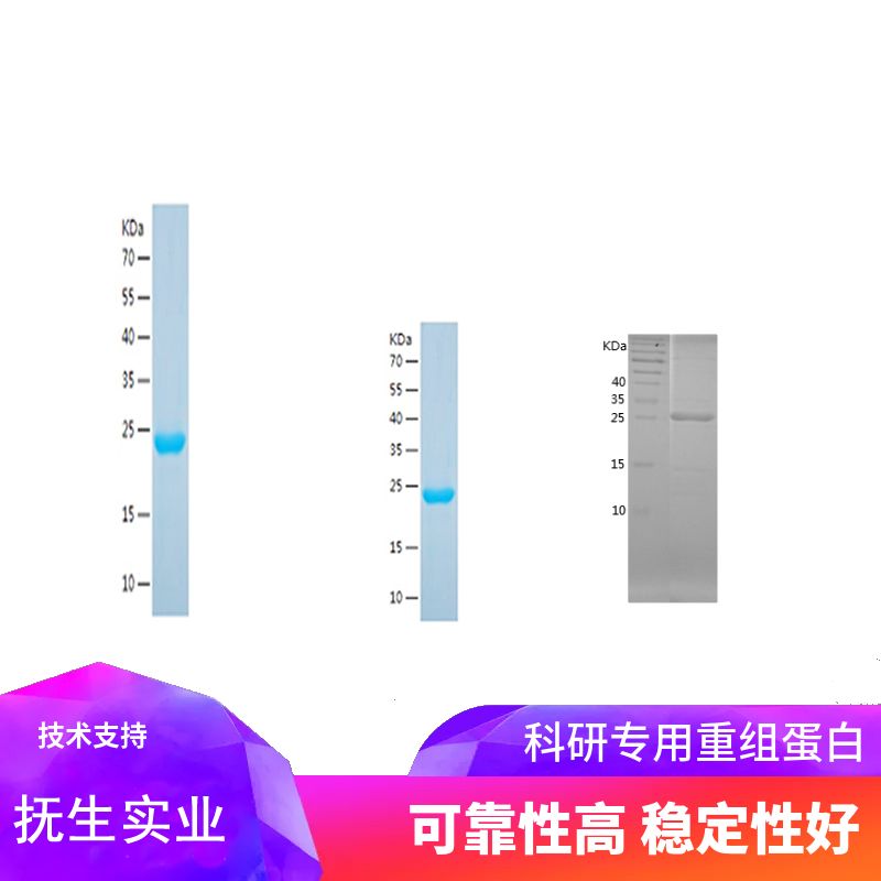 Recombinant Human E Cadherin