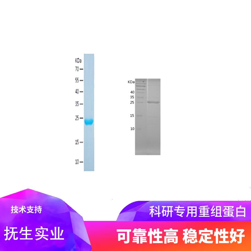 Recombinant Human LMCD1