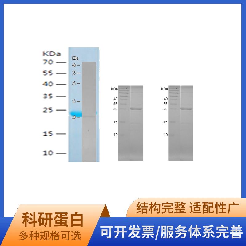 Recombinant Human PCAF
