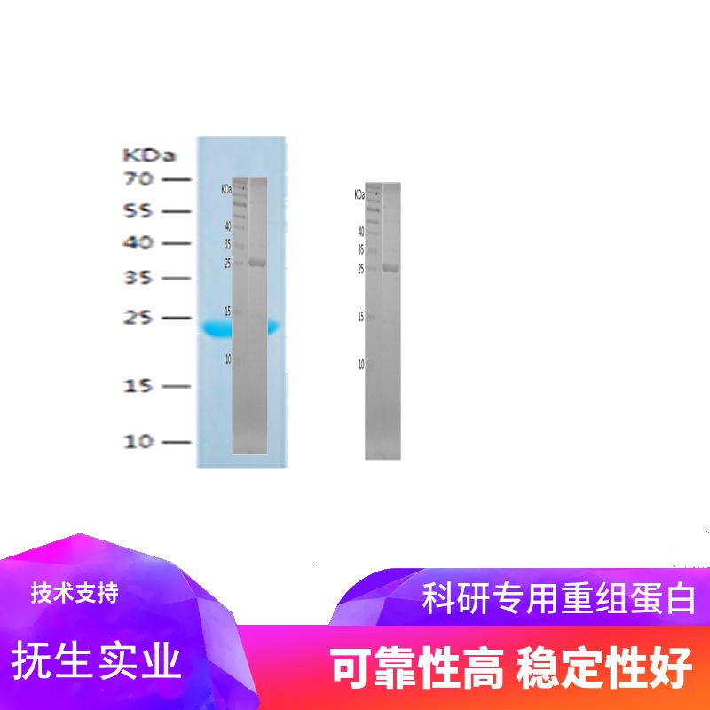 Recombinant Human Glycerol 3 Phosphate Dehydrogenase