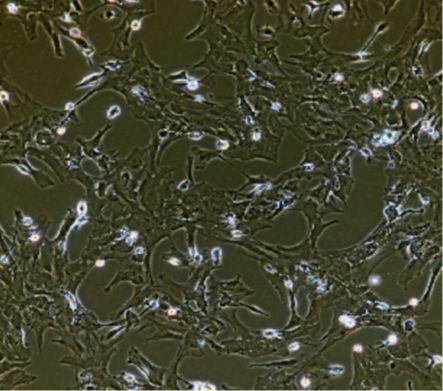 人非小细胞肺癌腺癌细胞；NCIH1993（STR鉴定正确）