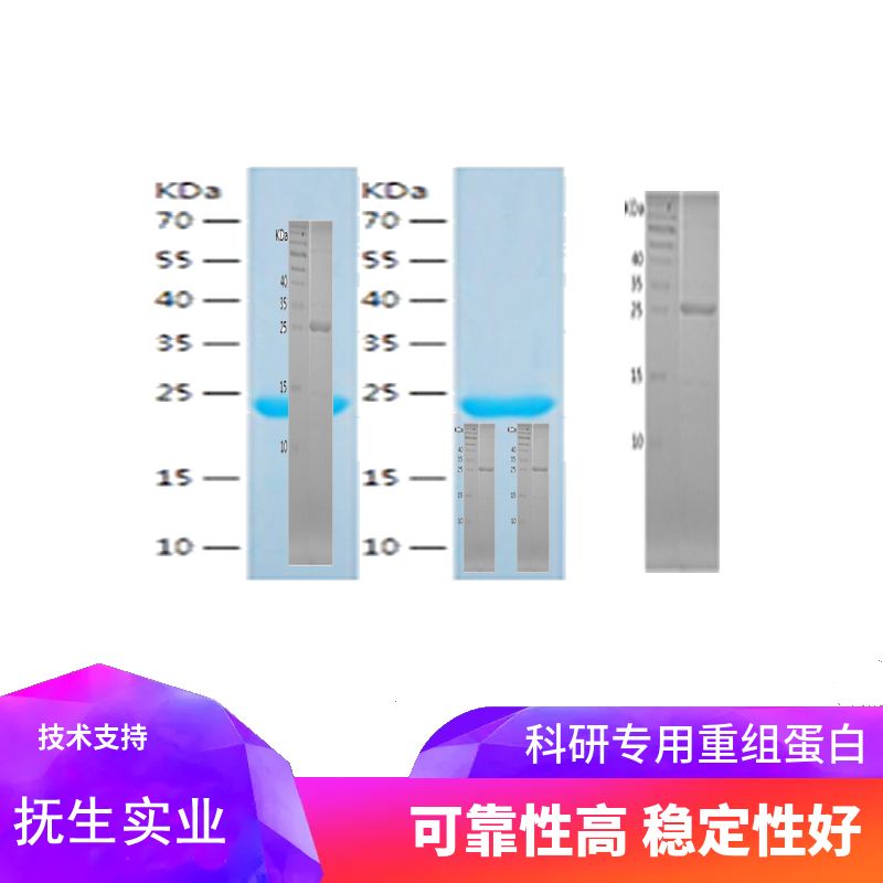 Recombinant Human Proteasome 20S beta 7