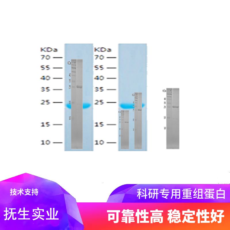 Recombinant Human DHODH