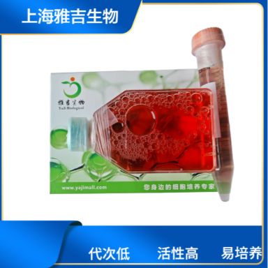 人脑星形细胞瘤SW1088（STR）
