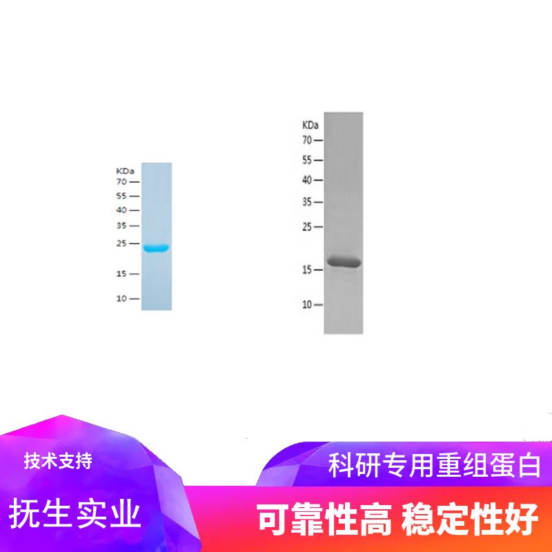 Recombinant Human DHRS4