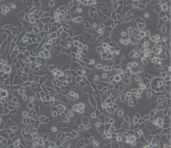人乳腺原发性导管癌（三阴性）HCC1599