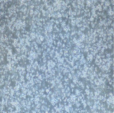 人肝癌SNU423细胞