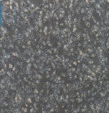 人皮肤鳞癌细胞系HSC5（STR）