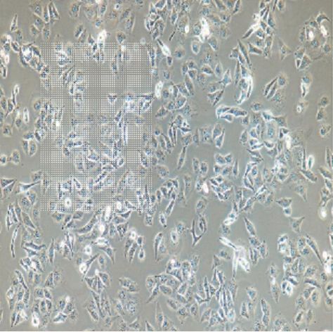 人胰腺导管癌细胞SU.86.86