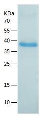 Recombinant Human CD5L.jpg
