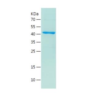 Recombinant Human Cdk2.png