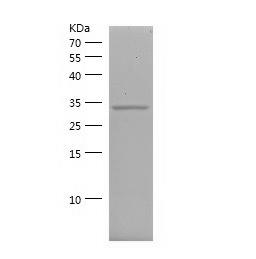 Recombinant Human CDK4.png