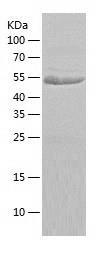 Recombinant Human CDK5RAP3.jpg
