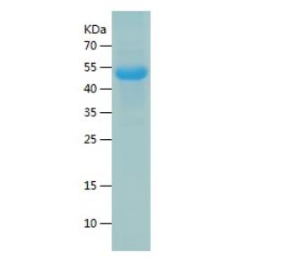 Recombinant Human CDR2.png