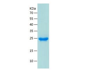 Recombinant Human CHD2.png
