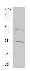 Recombinant Human CHMP1B.jpg