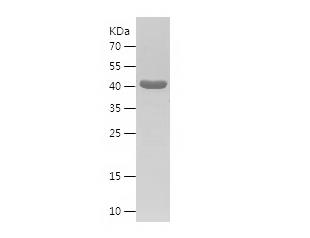 Recombinant Human Citrate synthetase.png