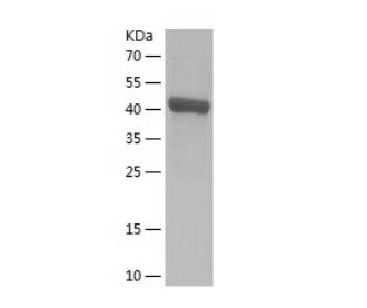 Recombinant Human CKMT2.png