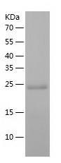 Recombinant Human CLIC5.jpg
