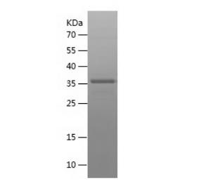 Recombinant Human Clusterin.png