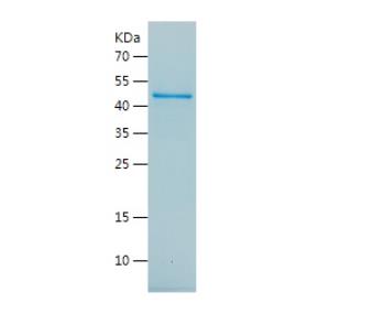 Recombinant Human c-Myc.png