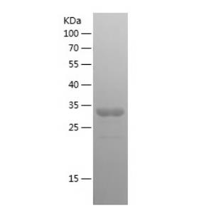 Recombinant Human Collagen VI alpha 2.png