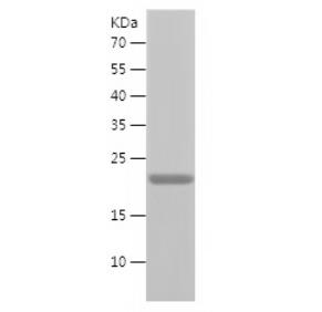 Recombinant Human COMMD1.png