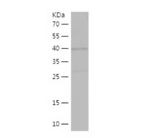 Recombinant Human COMT.png
