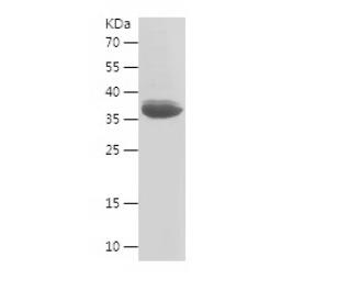 Recombinant Human COQ9.png