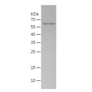 Recombinant Human CPOX.png