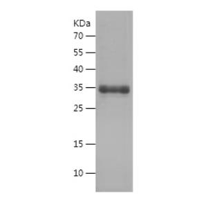 Recombinant Human CPT1A.png