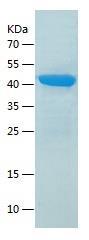 Recombinant Human Creatine Kinase MM.jpg