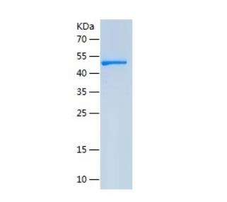 Recombinant Human CSK.png