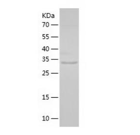 Recombinant Human CSPG4.png