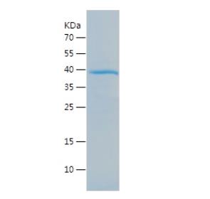 Recombinant Human CTCFL.png