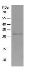 Recombinant Human CTDSP1.jpg
