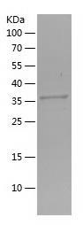 Recombinant Human CTHRC1.jpg