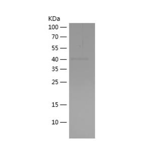 Recombinant Human CYLD.png