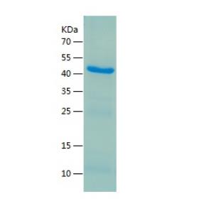 Recombinant Human Cytokeratin 18.png